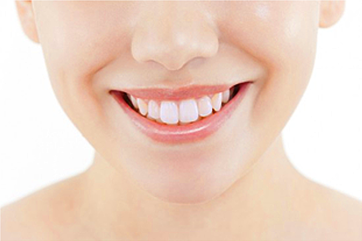 ホワイトニングイメージ