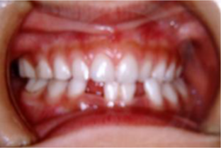 矯正歯科イメージ